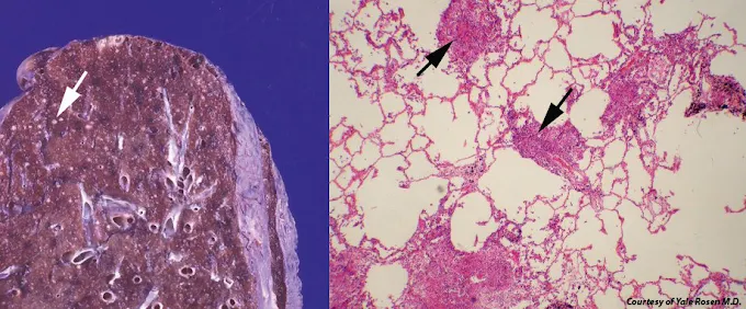Centre Ibn Rochd - Laboratoire d'Anatomie Pathologique 17